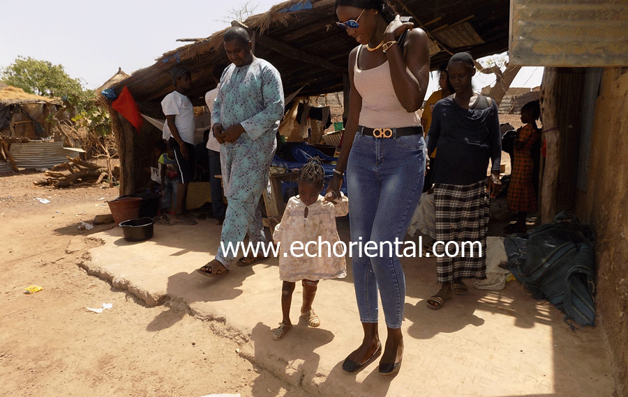 À Tamba : Ngoné Mamy Gueye et FST «sauvent» les pieds de la petite Juliette Bindia qui marche désormais
