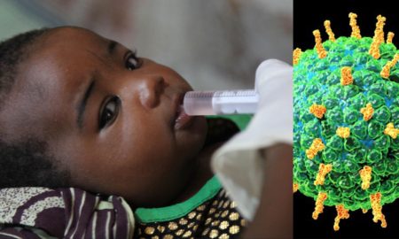 Épidémie de Rotavirus au Sénégal : de s’agit-il, ce que nous savons