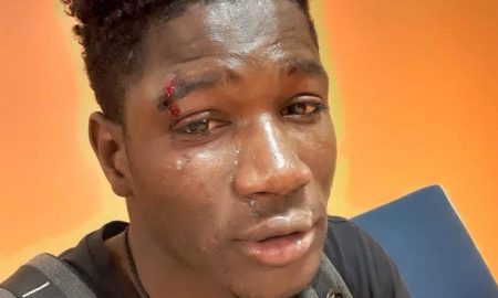 Boubacar Kandé, le migrant Sénégalais attaqué à Palerme
