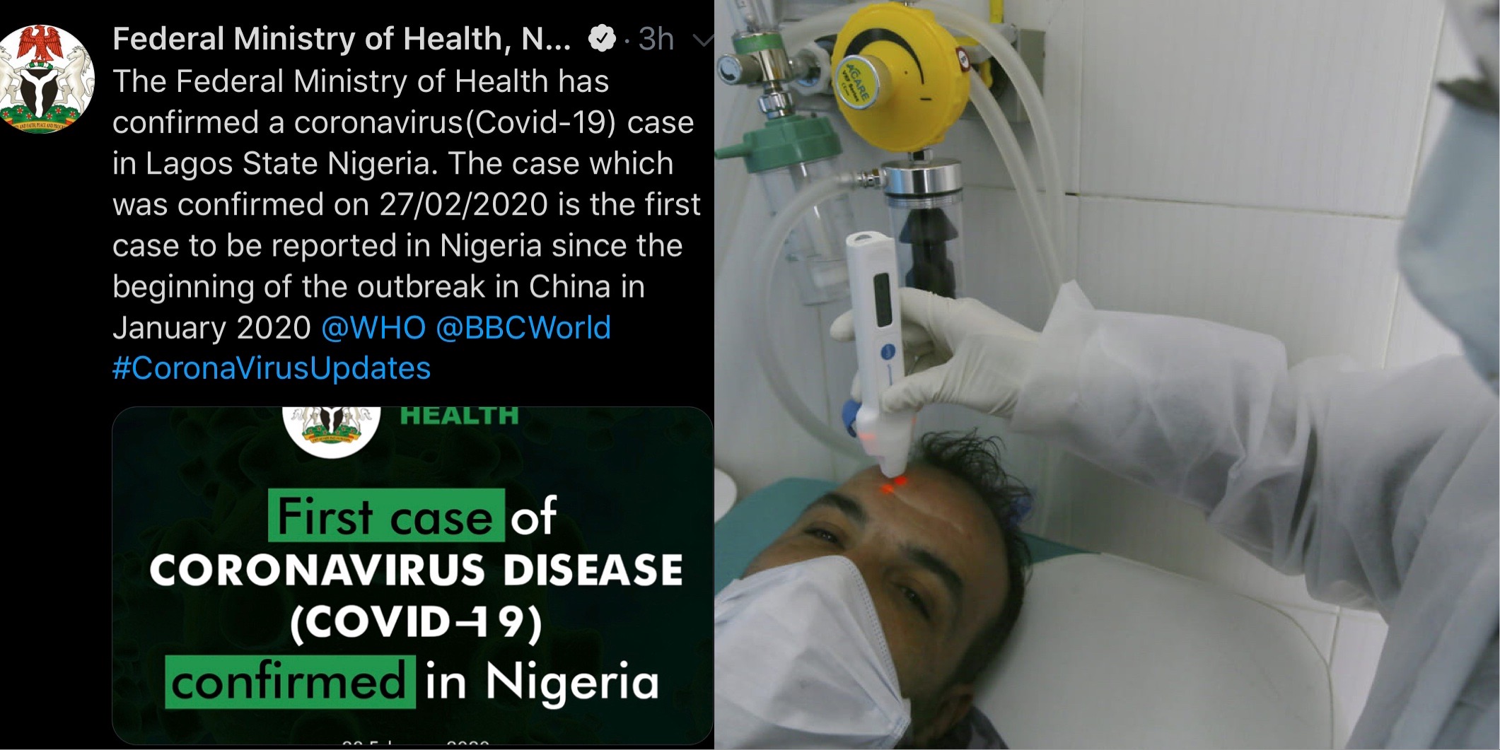 Nigeria: un 1er cas de Coronavirus confirmé par le ministère de la santé