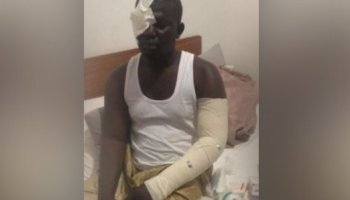 Violence électorale à Kaolack : séquestré, agressé et filmé, Ameth Cissé décide finalement de retirer sa plainte