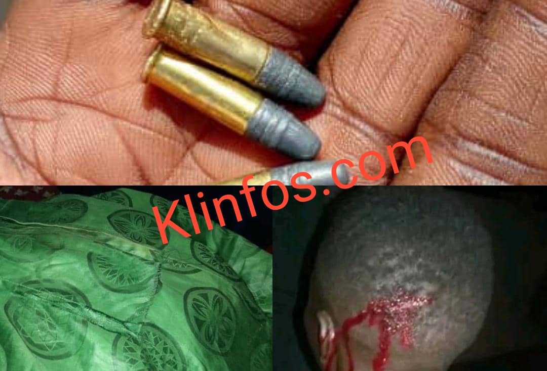 Kaolack : violents accrochages entre militants de BBY et ceux de Sonko, plusieurs blessés enregistrés