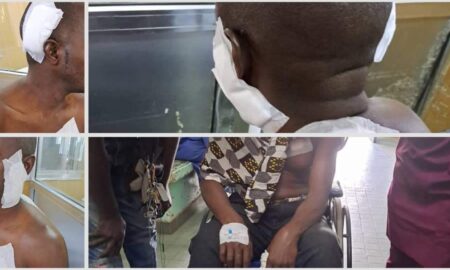 Kaolack : un responsable du Pds agressé et admis aux urgences de l'hôpital